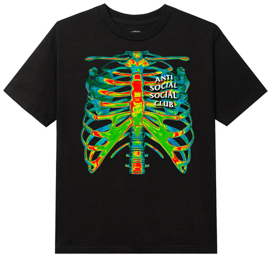 Anti Social Social Club Blow To The Chest Tee